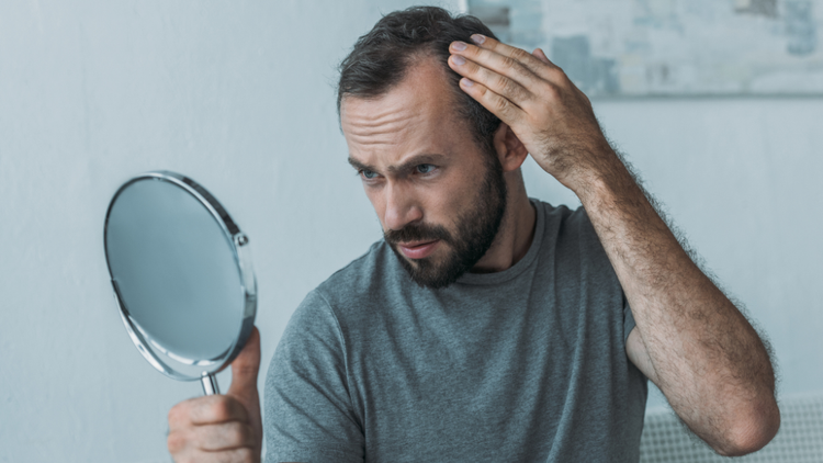 Hair Loss in Ireland Why It Happens & What Irish Men and Women Can Do About It