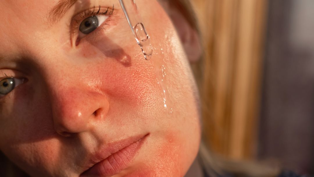 Rosacea Skincare Routine: How to Calm Facial Redness and Prevent Flare-Ups