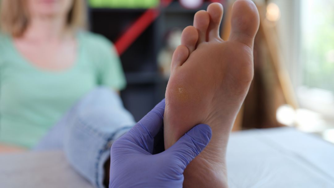 Warts, Verrucas & Skin Tags