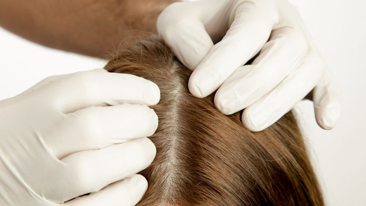 Woman experiencing a dry, flaky scalp while caring for her hair.