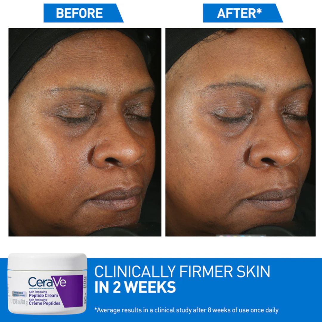 Before and after comparison of a woman's face with CeraVe Peptide Cream shown.
