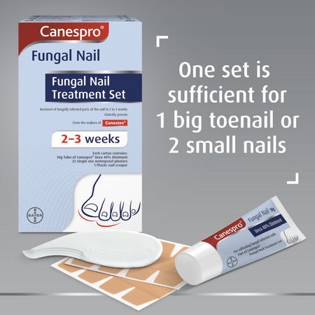 Canespro Fungal Nail Treatment Set shown with its retail box, a tube of treatment, a nail file, and adhesive pads on a gray background, with text stating one set is sufficient for 1 big toenail or 2 small nails.