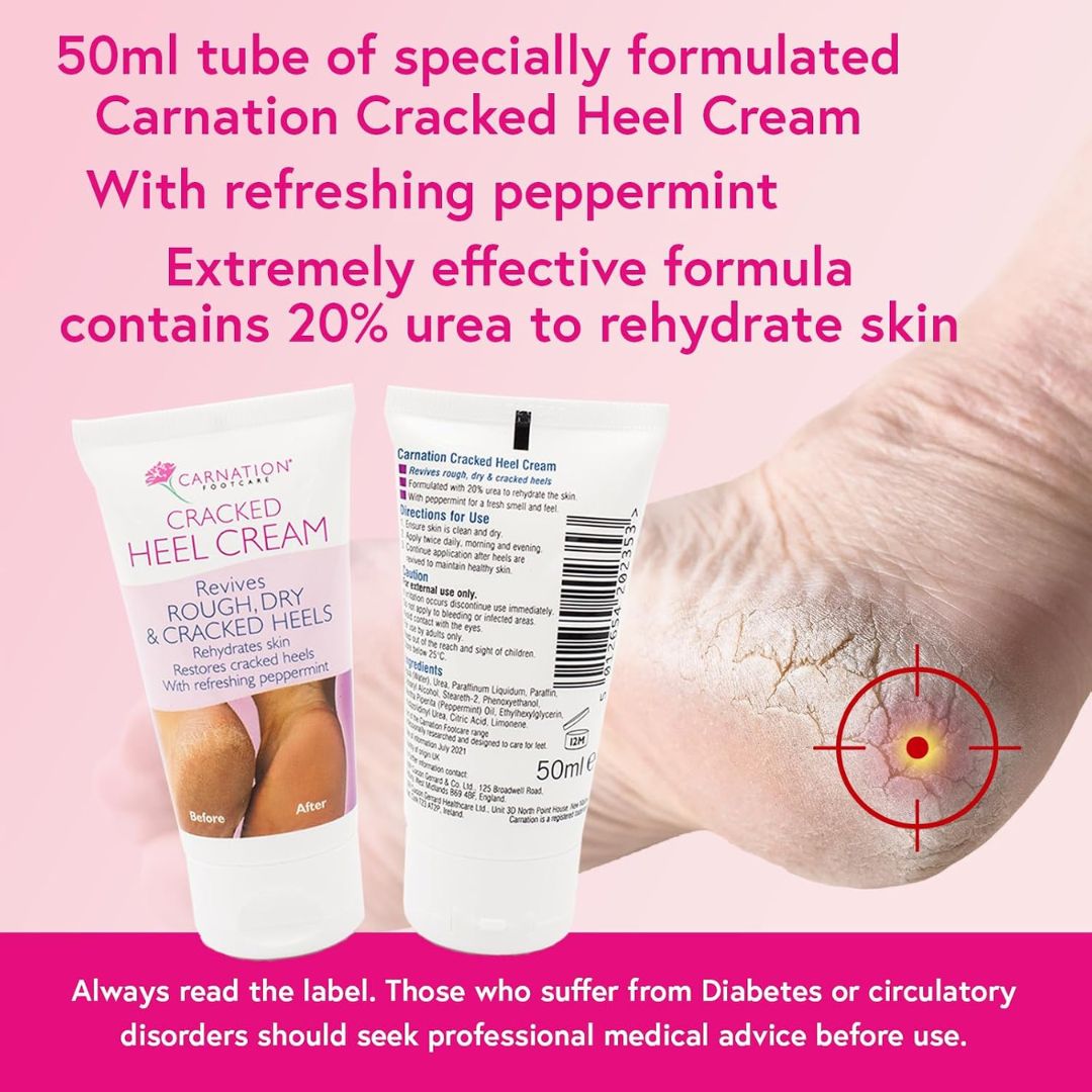 Promotional graphic for Carnation Cracked Heel Cream showing two tubes of the cream on a pink background, alongside a close-up of a cracked heel with a red target graphic and marketing text.