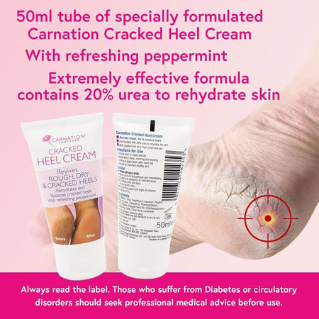 Promotional graphic for Carnation Cracked Heel Cream showing two tubes of the cream on a pink background, alongside a close-up of a cracked heel with a red target graphic and marketing text.