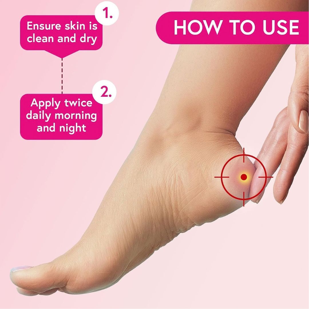 Carnation Cracked heel cream with foot on pink backround