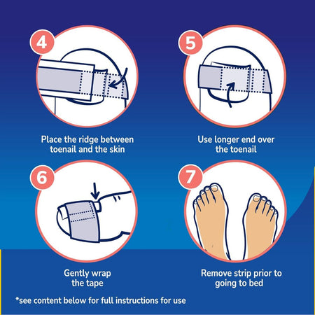 Dr. Scholl's Ingrown Toenail Pain Relief Strips 'HOW TO USE' graphic