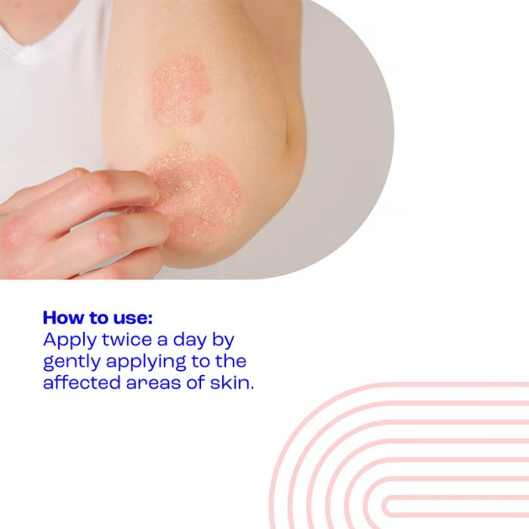Instructional graphic showing a close-up of a person's elbow with dry, cracked skin and a hand touching it, with text reading 'How to use: Apply twice a day by gently applying to the affected areas of skin.'.
