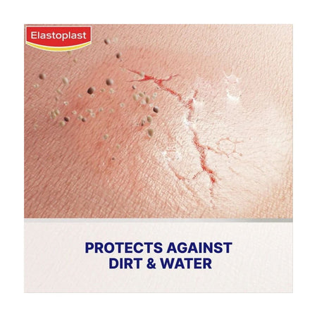 Elastoplast Liquid Plaster Concentrate graphic showing product on skin with the words 'PROTECTS AGAINST DIRT & WATER'