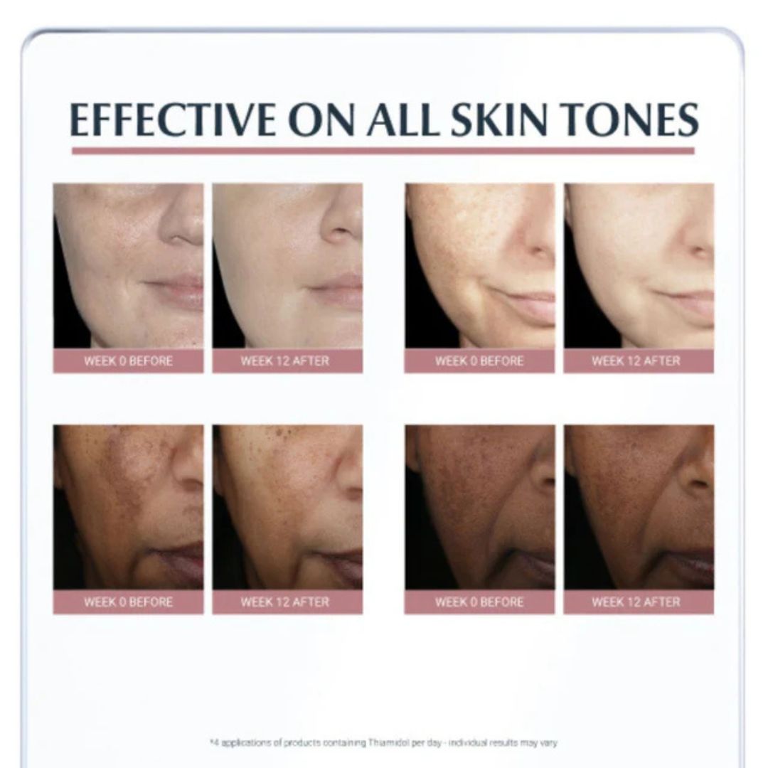 Before and after skin treatment results on various skin tones with text 'Effective on all skin tones'.