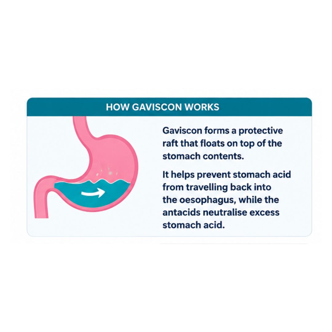 Gaviscon Liquid Aniseed Oral Suspension 'HOW GAVISCON WORKS' graphic