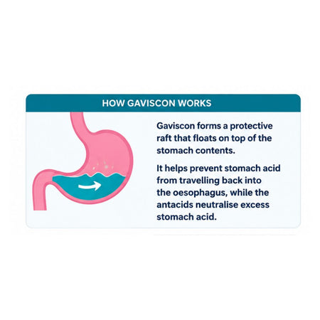 Gaviscon Liquid Aniseed Oral Suspension 'HOW GAVISCON WORKS' graphic