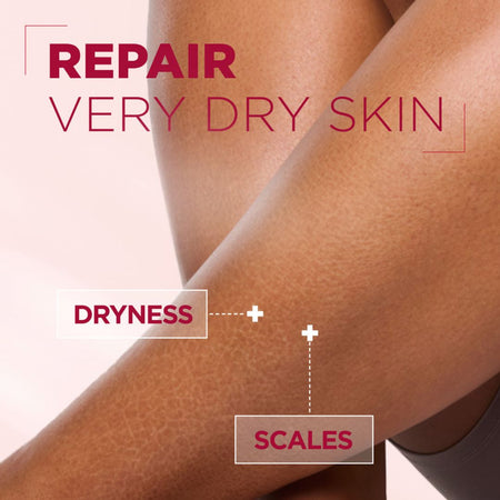 Close-up of crossed legs with visible dry, cracked skin and overlaid text reading 'REPAIR VERY DRY SKIN,' 'DRYNESS,' and 'SCALES' with dotted callouts.