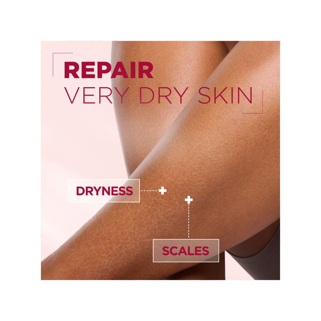 A close-up of crossed legs with dry, cracked skin, overlaid with the text 'REPAIR VERY DRY SKIN' and labels pointing to 'DRYNESS' and 'SCALES'.