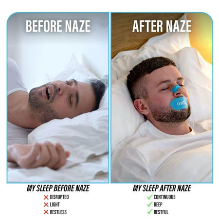Before and after comparison of a person sleeping with and without a device labeled 'NAZE'.