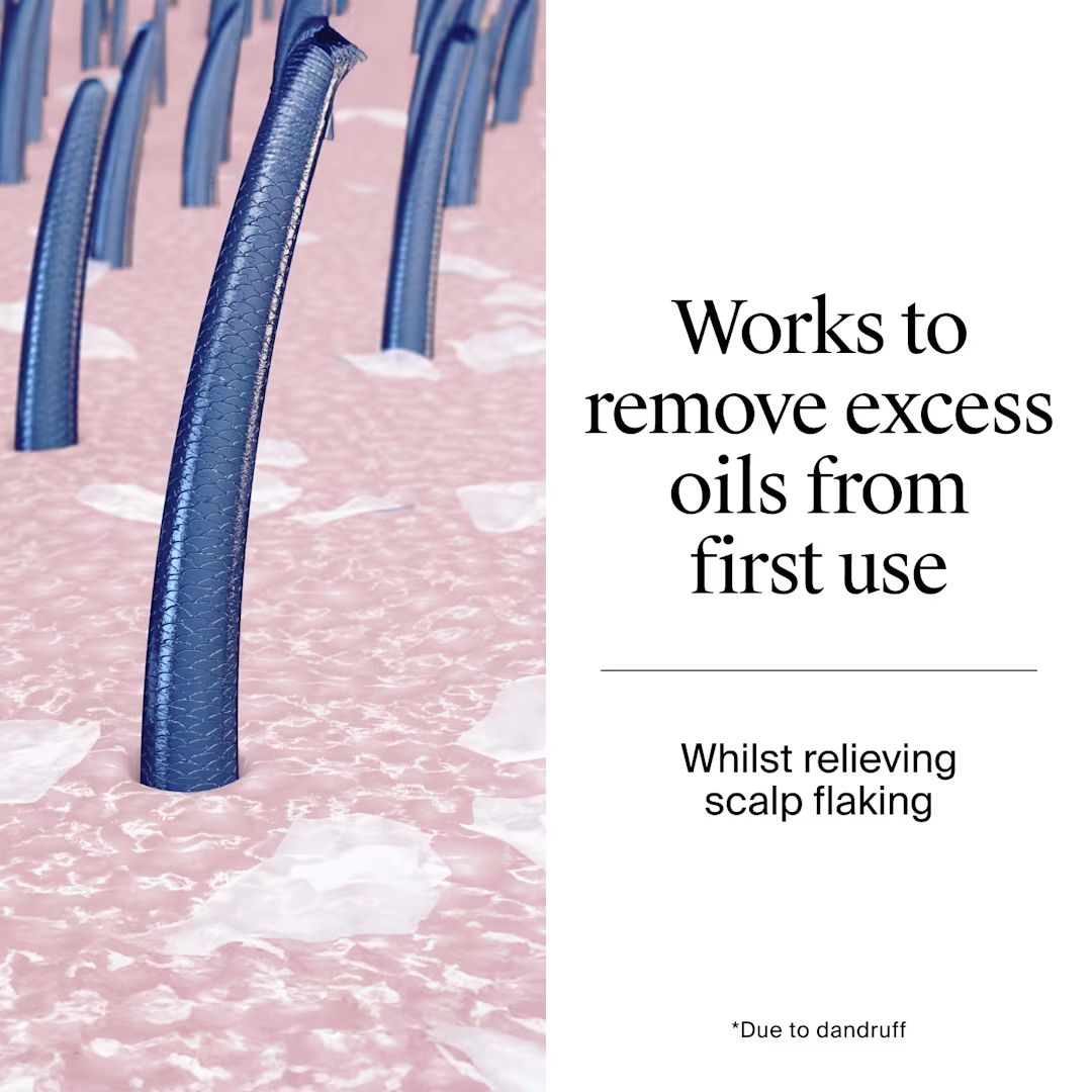 Promotional graphic with a close-up illustration of blue hair strands rising from pink scalp texture on the left, and black text on a white right panel reading 'Works to remove excess oils from first use' and 'Whilst relieving scalp flaking'.