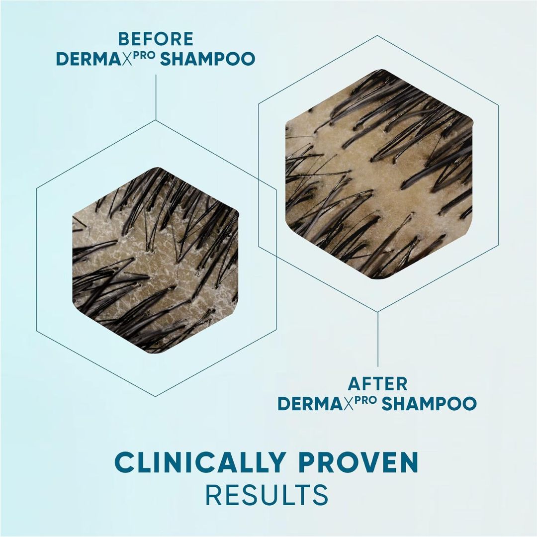 Before and after comparison of hair with DermaPro shampoo on a light blue background