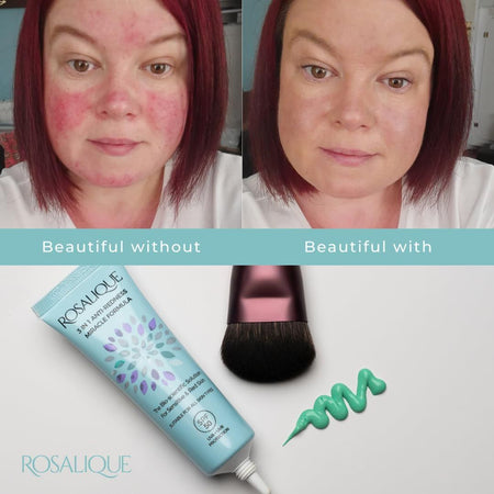 Before and after comparison of a woman's face with Rosalique product and brush.